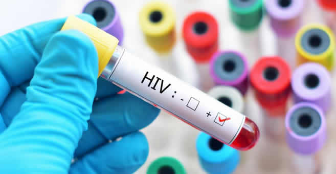 Test Rápido de HIV-Sida gratis con resultado en el día – EconoBlog